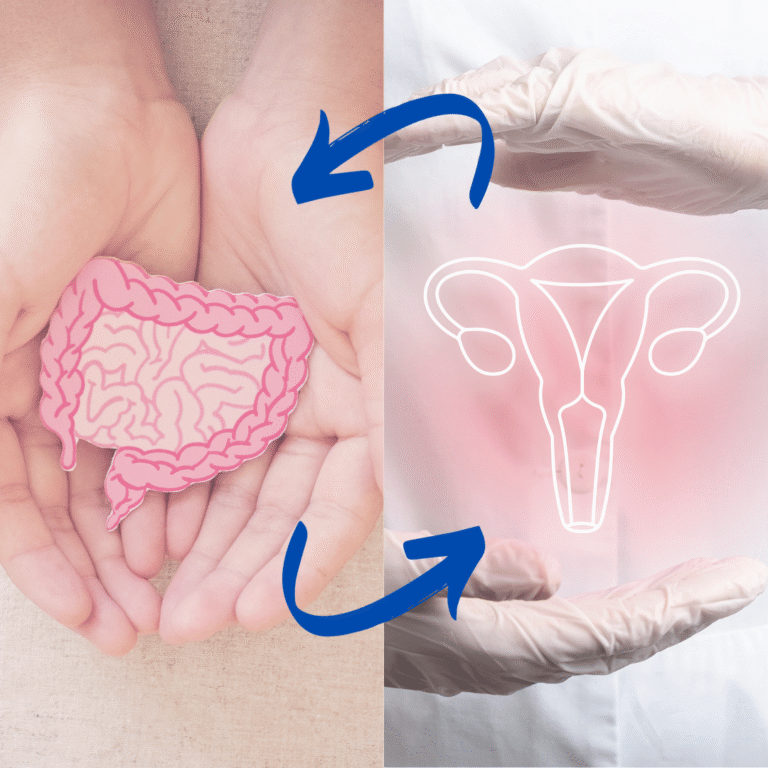 Gut-Health-and-Endometriosis-link-1